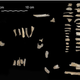 Human bone fragments.